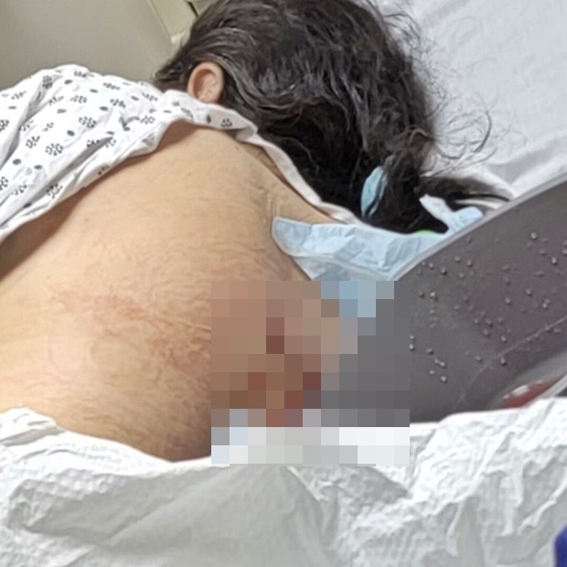 신원 공개를 거부한 피해 여성은 “누군가 뒤에서 갑자기 밀쳐 넘어졌다. 가방을 뺏겼고 칼에 찔렸다”고 밝혔다.