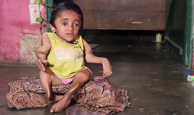 그래도 소년은 구김 없는 모습으로 집안에서 귀여움을 독차지하고 있다. 가수의 꿈도 품고 있다. 데일리메일에 따르면 비록 몸은 불편하지만 꿈을 이루지 못할 이유는 없다는 게 소년 생각이다.