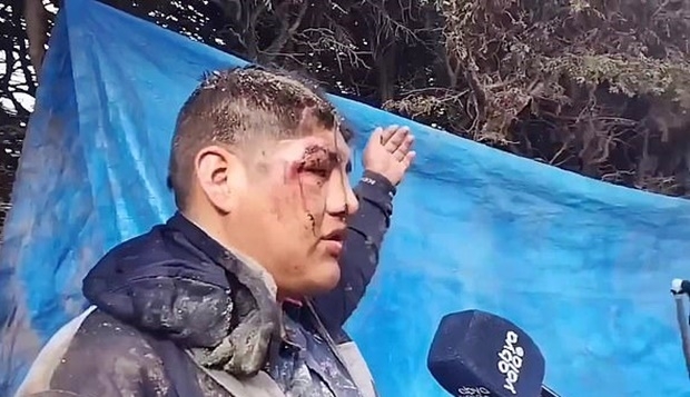 알바레즈는 “댄서인 나는 축제장에 사전 입장했다. 그 곳에서 관계자들과 맥주 몇 잔을 마신 후 의식을 잃었다”고 밝혔다. 그는 “그 후로 더이상 기억이 나지 않는다. 침대에 누워 있다가 화장실을 가려고 일어났는데 몸이 움직이지 않았다”고 설명했다. 출처=파지나 시에테