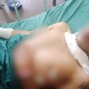 [여기는 베트남] 오토바이 운전자 연줄이 목에 감겨 혼수상태