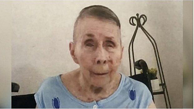 1992년 펜실베니아 로스 타운십에서 실종된 뒤 사망신고까지 됐던 패트리샤 콥타가 30년 만에 푸에르토 리코의 한 노인보호시설에서 생활 중인 것으로 밝혀졌다. 사진은 요양원에서 생활중인 모습. 사진:로스 타운십 제공.