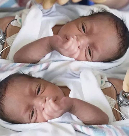 우간다 70세 여성이 낳은 쌍둥이 남매의 모습.