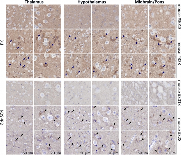 만성소모성질병(CWD)에 감염된 사슴에게서 채취한 프리온을 인간화된 쥐에 주입한 실험.