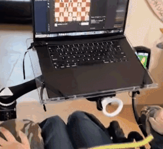 뇌신경과학 스타트업 기업인 뉴럴링크를 이끌고 있는 일론 머스크가 뇌에 컴퓨터 칩을 이식한 환자(영상)가 생각만으로 체스를 두는 모습을 최초로 공개했다