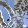 현미경으로 본 미국과 영국 수돗물···네티즌들 ‘경악’