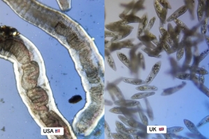 현미경으로 본 미국과 영국 수돗물···네티즌들 ‘경악’