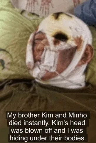 지난달 말 우크라이나 성향 텔레그램 채널에 동료를 모두 잃고 홀로 살아남은 북한군 병사의 인터뷰라는 영상이 올라왔으나 진위여부는 확인되지 않았다.