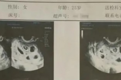 ‘아홉 쌍둥이’ 임신한 20대 여성···의료과실 주장, 왜?