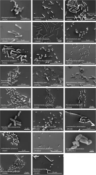 피닉스 우주선 조립 무균실에서 분리한 일부 신종 미생물들의 주사전자현미경 속 모습. 출처=마이크로바이옴(2025)