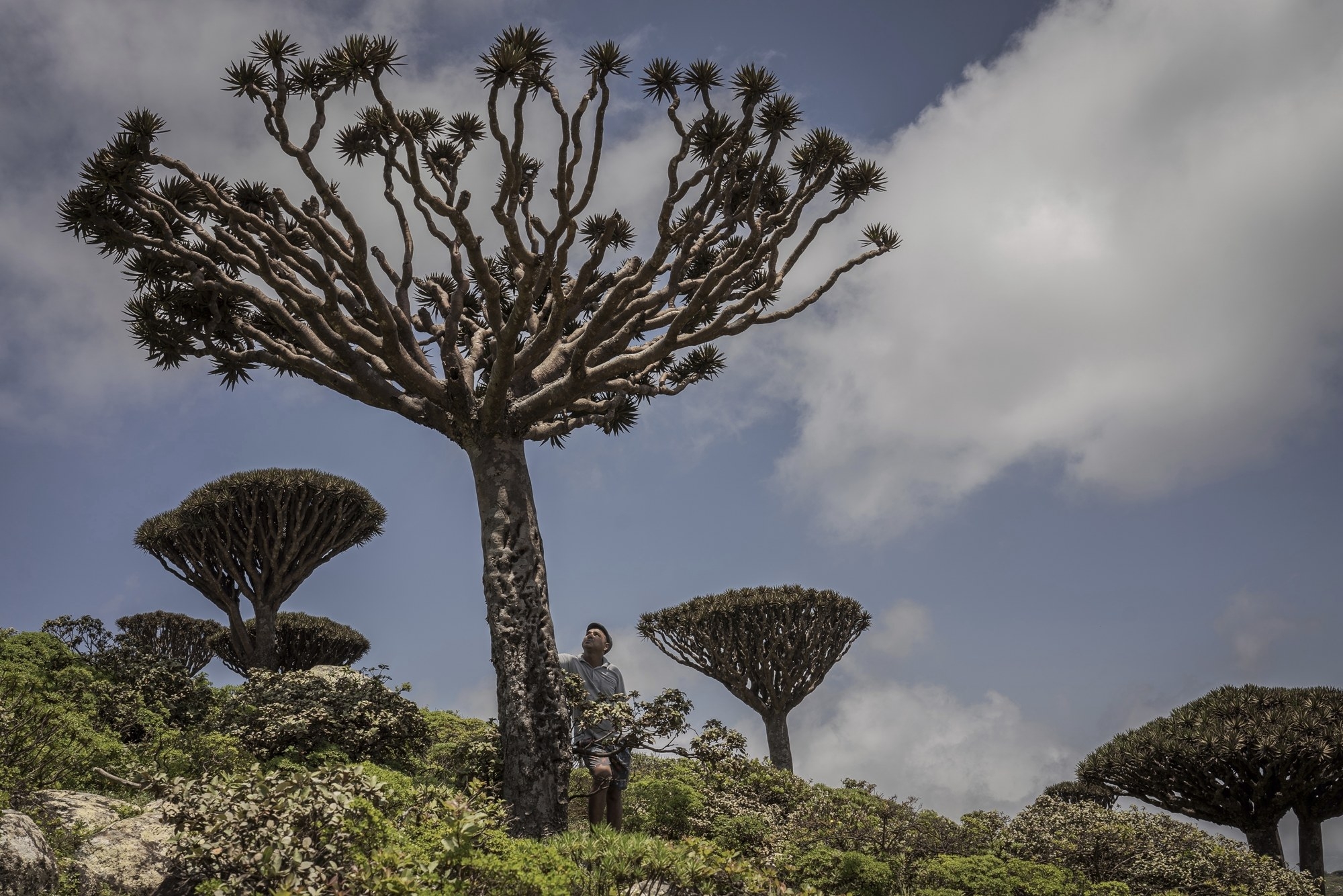 Climate Yemen Dragons Blood Trees  소코트라섬의 현지 가이드가 용혈수를 바라보고 있다.  AP 연합뉴스 자료사진