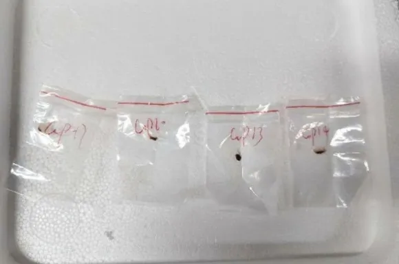 지난해 중국 과학자가 미국에 입국할 당시 배낭에 숨겼던 독성 식물 병원균. 미시간 동부지방법원 제공. AP 연합뉴스