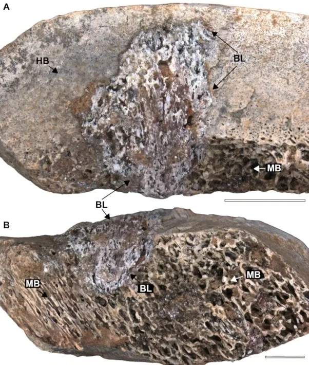 골수염의 흔적 (BL)이 남아 있는 공룡뼈 화석. Credit: Tito Aureliano et al./The Anatomical Record