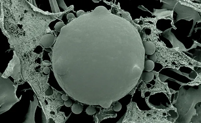 양서류 호상균 혹은 항아리 곰팡이 전자 현미경 이미지. Photo credit: Dr Alex Hyatt, CSIRO Livestock Industries‘ Australian Animal Health Laboratory (AAHL)
