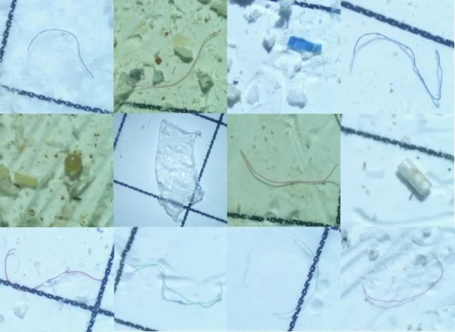 인더스강돌고래의 위장관에서 나온 미세 플라스틱. 출처 Ahsaan Ali, CC-BY 4.0 (https://creativecommons.org/licenses/by/4.0/