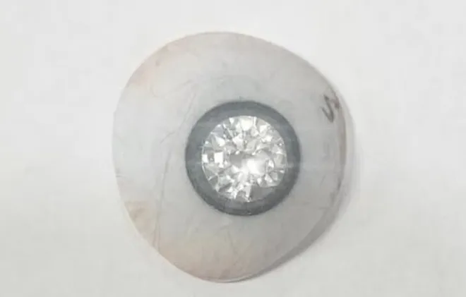 미국 남성 슬레이터 존스가 다이아몬드 2캐럿을 넣어 만든 의안. 인스타그램 캡처 미국 남성 슬레이터 존스가 다이아몬드 2캐럿을 넣어 만든 의안. 인스타그램 캡처