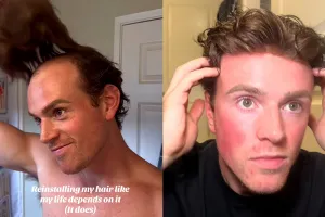 탈모남의 자기관리란 이런 것...☆