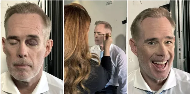 ESPN의 NFL 간판 캐스터 **조 벅**이 왼쪽 눈 주변에 생긴 검은 멍을 공개했다(왼쪽). 이어 메이크업 스태프가 멍을 가리는 작업을 진행했고(가운데), 화장을 마친 뒤에는 생중계에서도 이상이 드러나지 않는 모습이 연출됐다(오른쪽). 조 벅 X