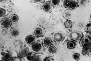 “생각보다 오래된 불청객”…2500년 전 헤르페스 감염 증거