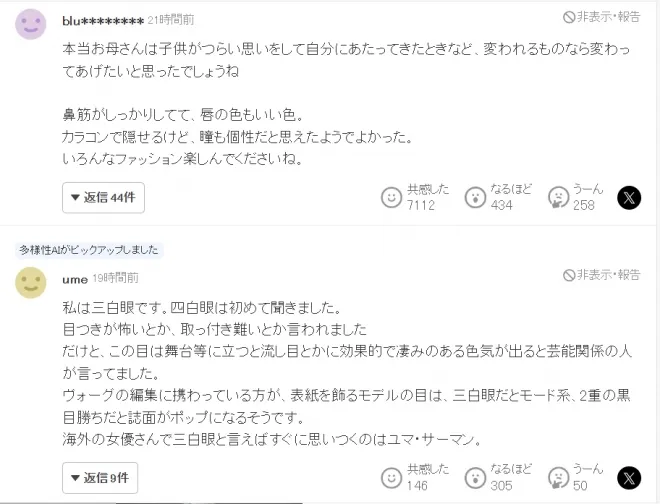 아카네코의 사연이 소개된 야후재팬 기사에는 “개성으로 받아들여 멋지다” 등 공감 댓글이 이어졌다. 야후재팬 캡처