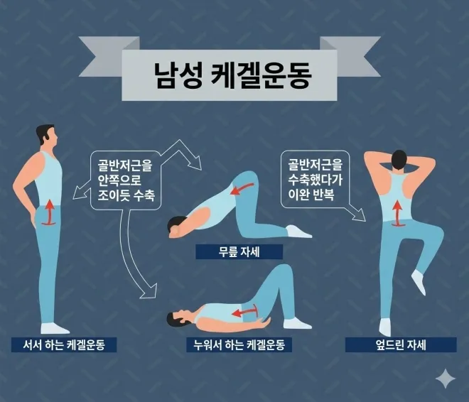 골반저근을 강화하는 케겔운동(케겔 체조) 방법을 설명한 일러스트. 조루 관리와 성기능 개선에 도움이 되는 운동으로 알려져 있다. 123RF 자료를 바탕으로 제작