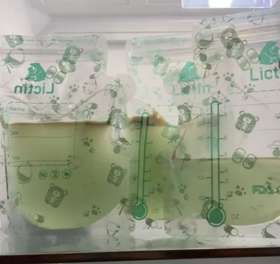 티아 도일이 비만세포 활성화 증후군(MCAS) 치료 중 확인한 초록색 모유. 더 미러 제공