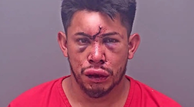 “엄마 목 조르자 주먹 날렸다”…13세 아들, 술 취한 아버지 KO [핫이슈]