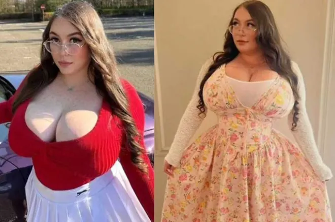 스코틀랜드 여성 서머 로버트(28). 피플 닷컴 제공