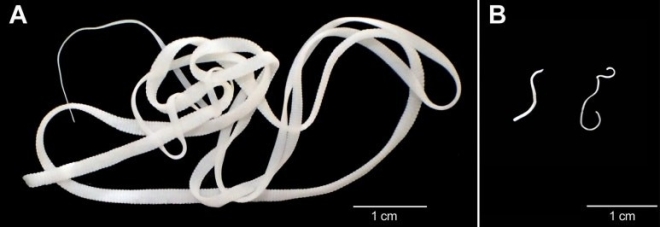 “우리도 식이섬유가 필요해” 기생충도 식이섬유 좋아한다? [핵잼 사이언스]