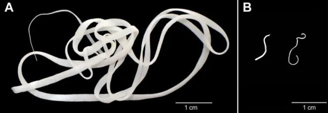 쥐촌충. A는 식이섬유가 풍부한 환경. B는 식이섬유가 부족한 환경에서 자란 쥐촌충. Biology Centre CAS