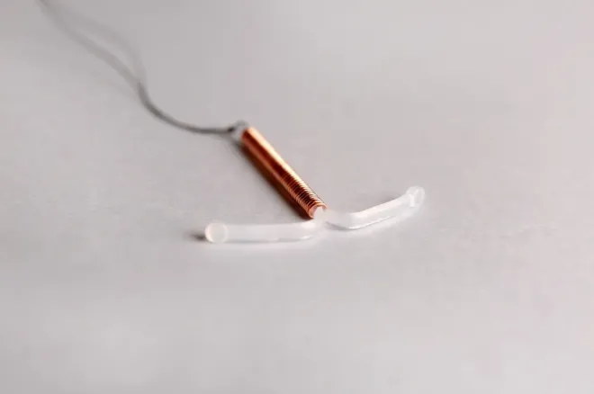 자궁 내 장치(IUD) 피임 기구 자료사진. 기사와 관계 없음. 123rf.com