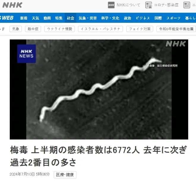 일본 NHK 2024년 매독 증가 관련 보도 캡처