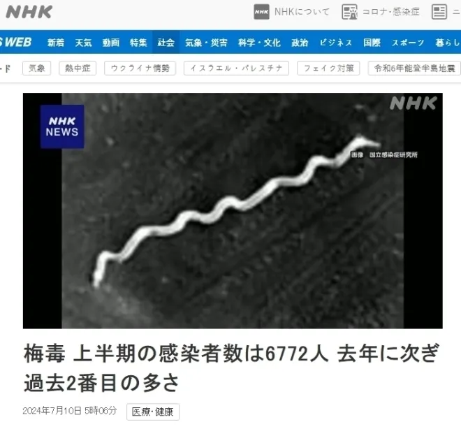 일본 NHK 2024년 매독 증가 관련 보도 캡처
